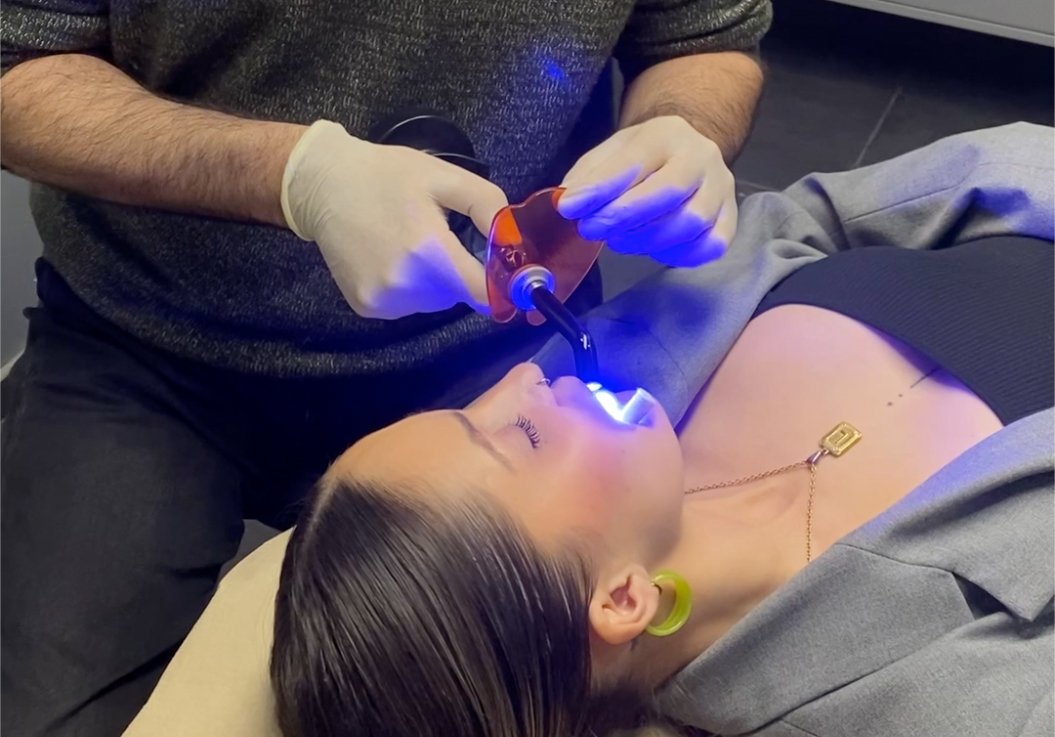 Gemas dentales en Lleida. ZUK Tattoo Piercing